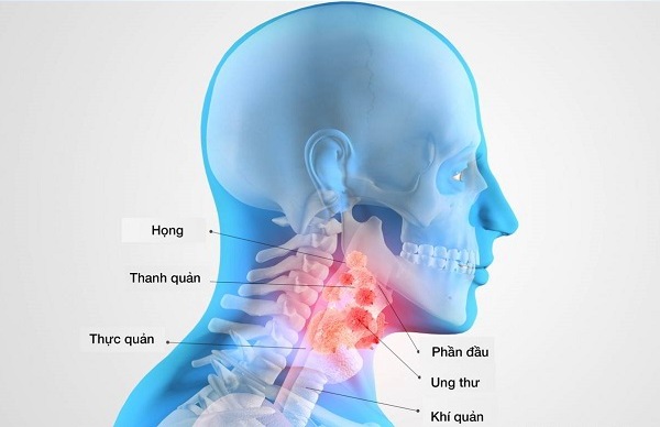 Tìm hiểu về vị trí của ung thư vòm họng 1 Tìm hiểu về vị trí của ung thư vòm họng 1
